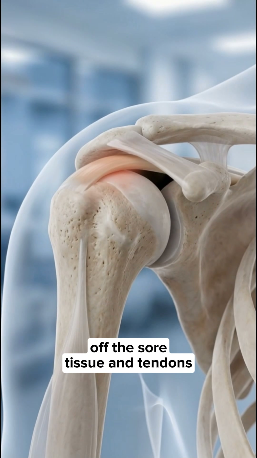 The Easiest Shoulder Relief Ever. [On Sale Today]