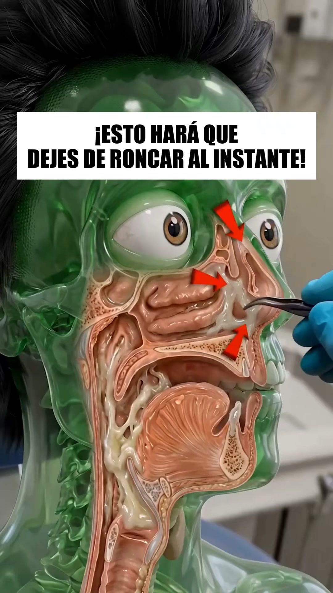 ¡La forma más inteligente de dejar de roncar!