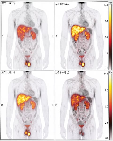 Why Liver Supplements Stall