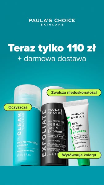 Niedoskonałości ?