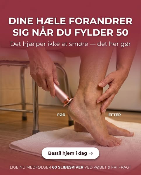 Grovile hæle forsvinder ikke af sig selv