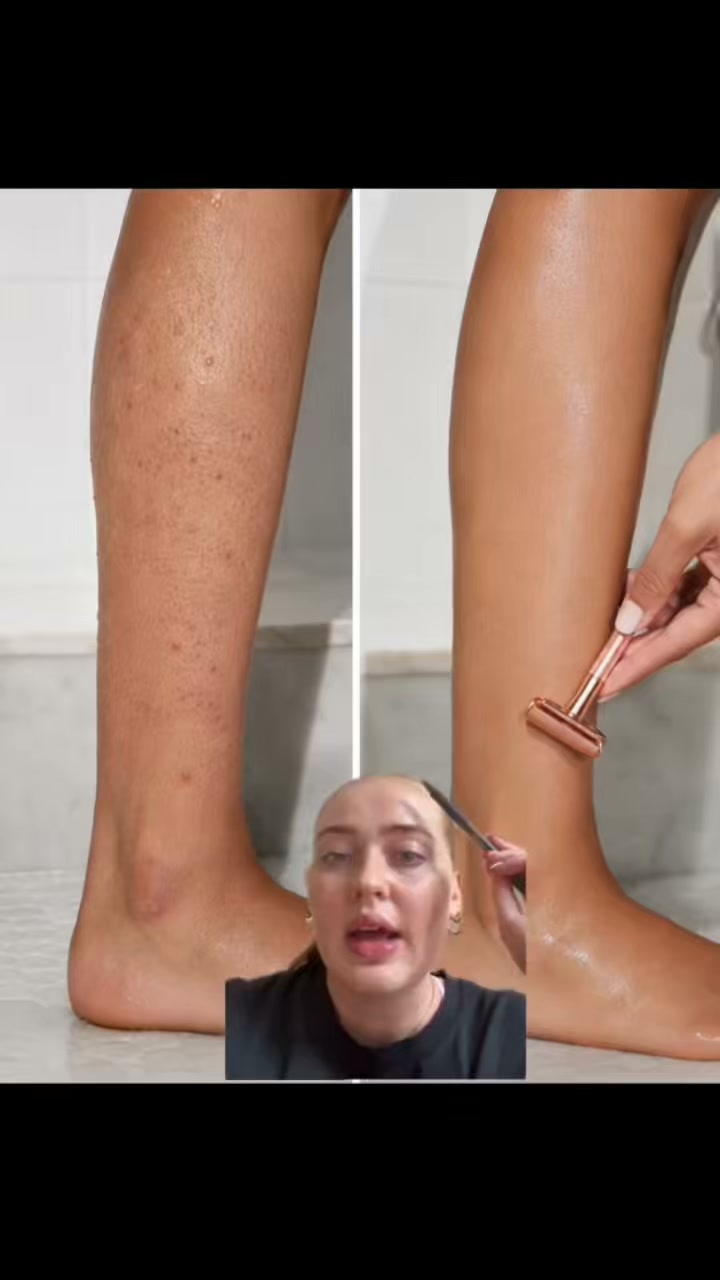 Strawberry legs? It's your razor, not your skin.