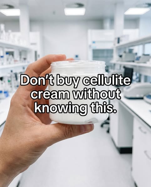 my cellulite is gone