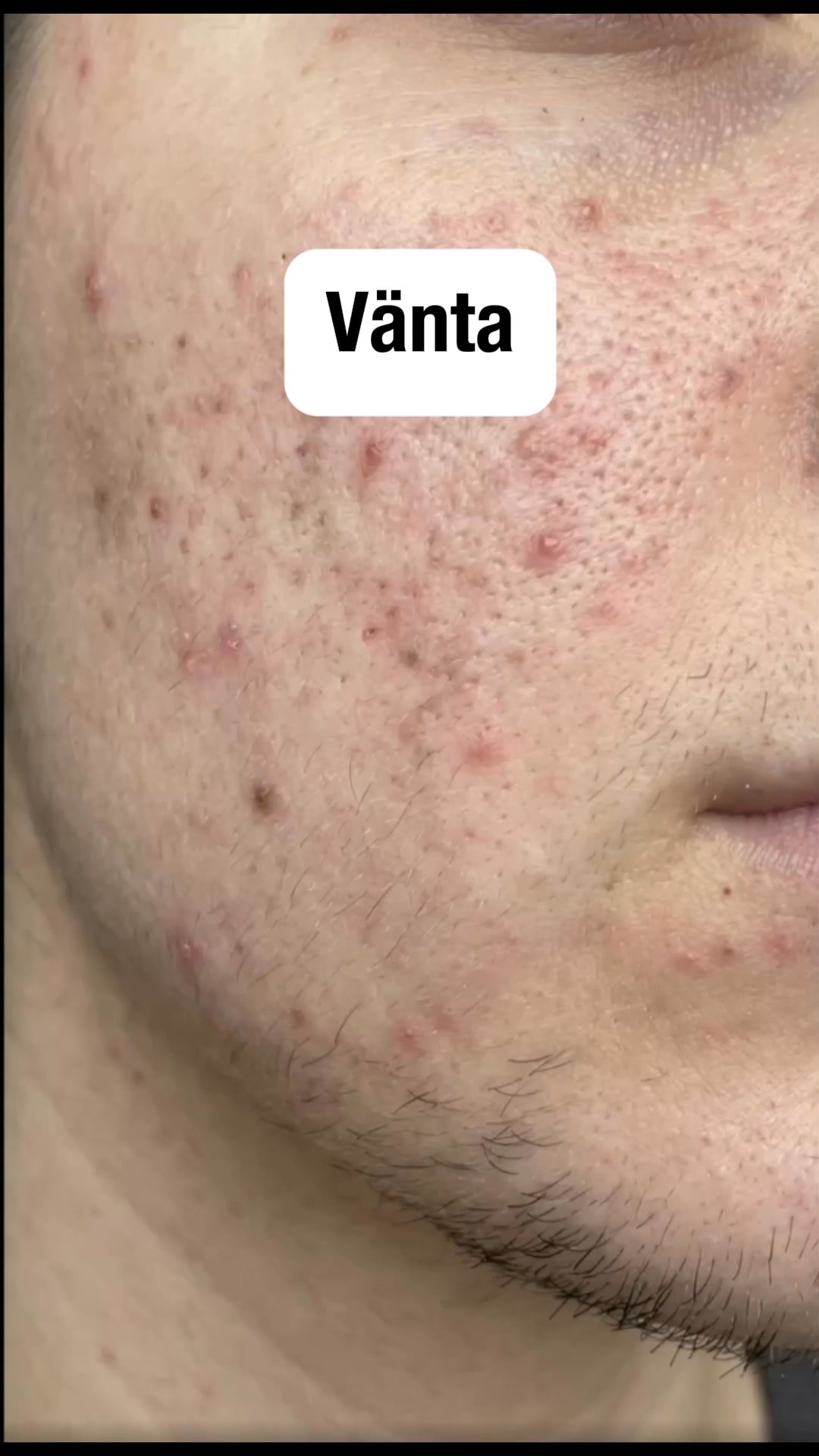 Betala senare med Klarna