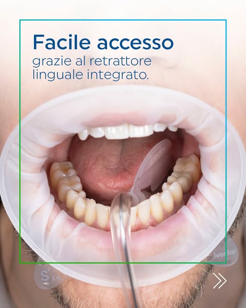 OptraGate 2: nuovo design con l'aggiunta del terzo anello