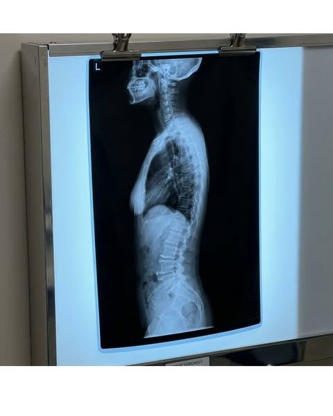 What surgeons will NOT tell you