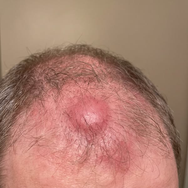Before You Buy Another DHT Formula For Your Hair Loss, Read This