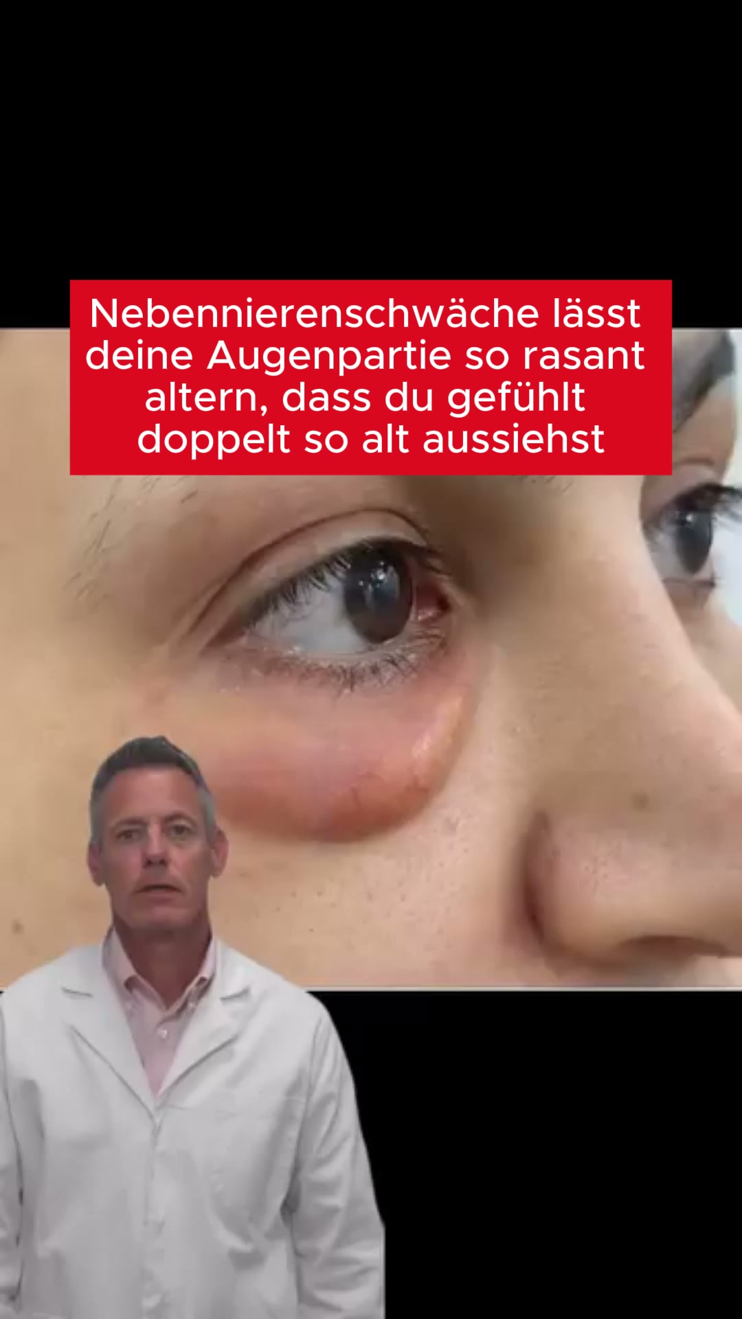 Keine OP. Kein Botox. Keine Filler. Nur Lichttherapie