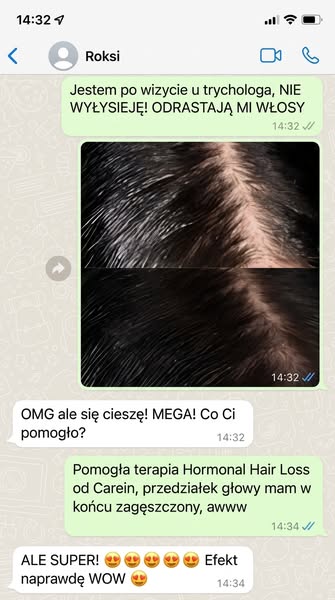 Zatrzymaj przerzedzenie na czubku głowy