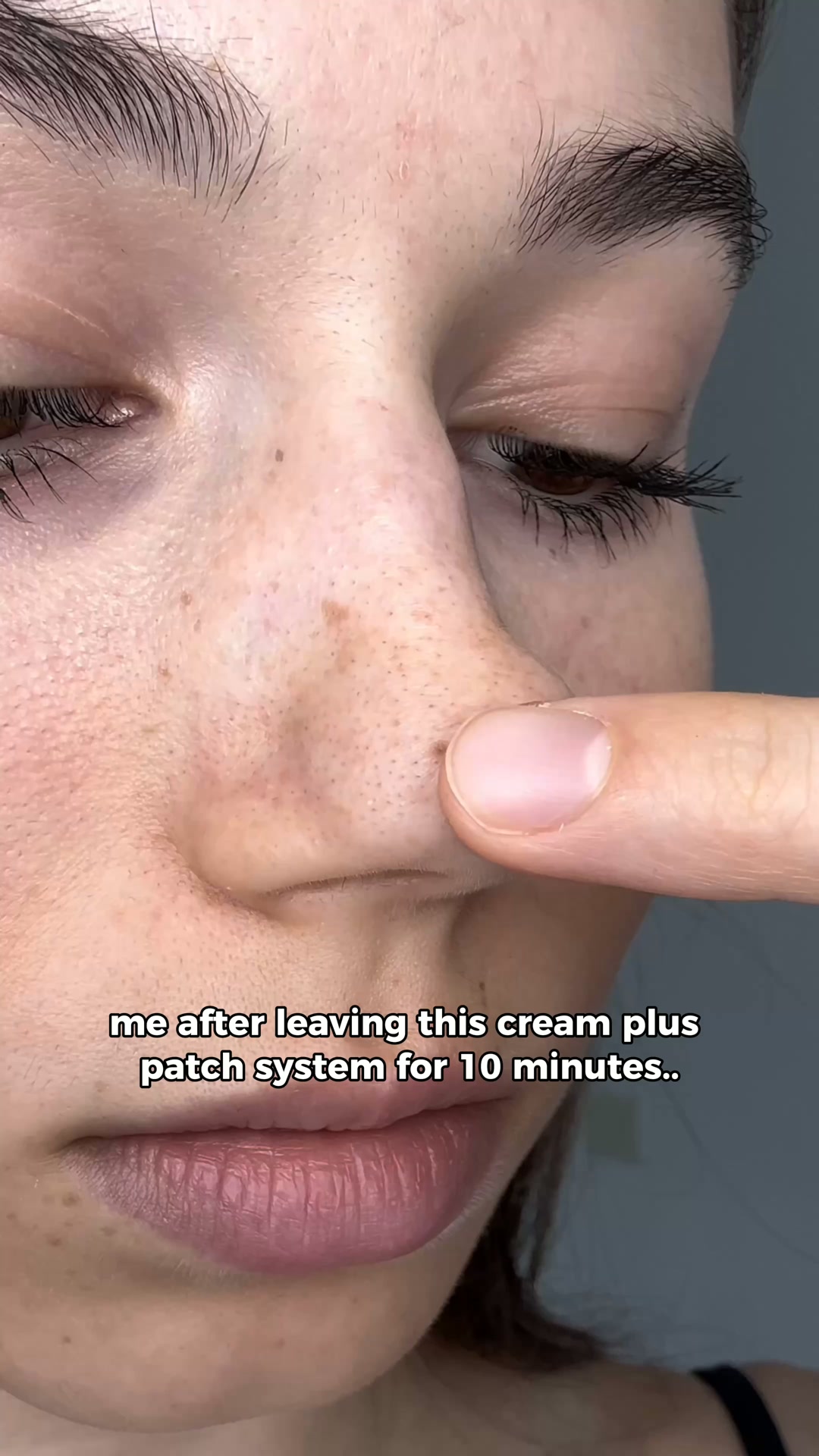 Eliminate Clogged Pores - Fast