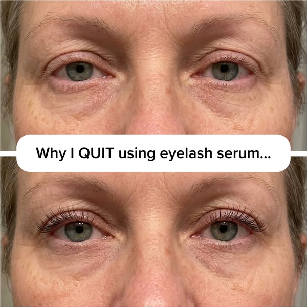 The Truth About Eyelash Serum