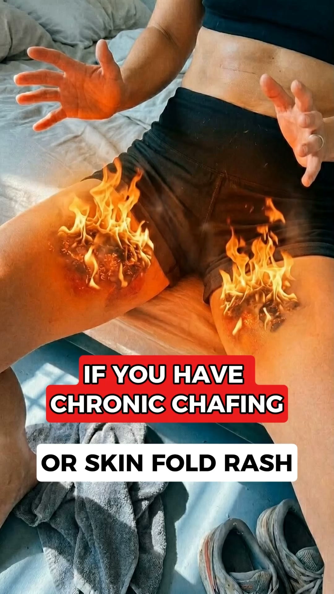 Chafing rashes? Not anymore! Sale Ends Tonight!