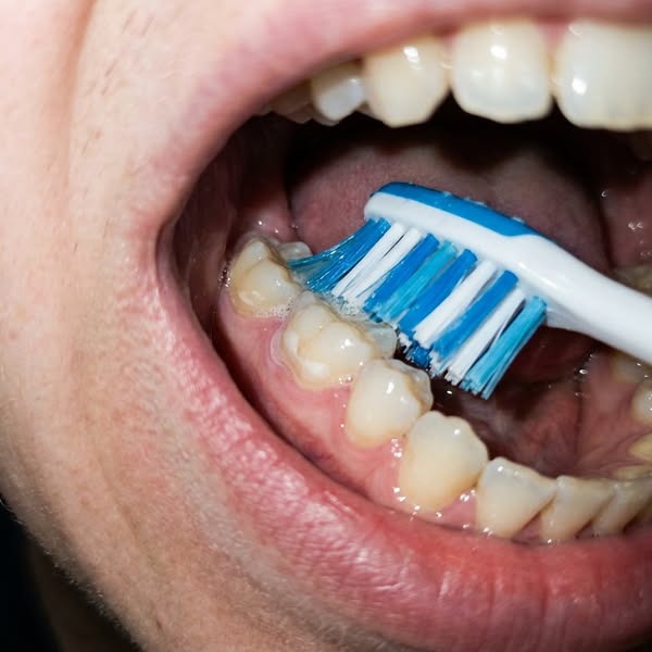 Read this if you have a damaged enamel...