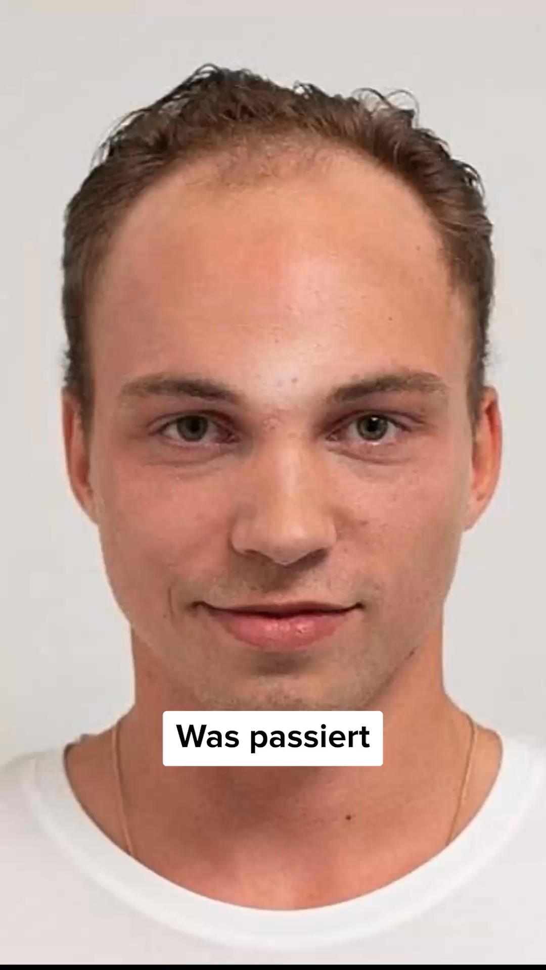 Volles Haar in 3-5 Wochen oder Geld zurück.
