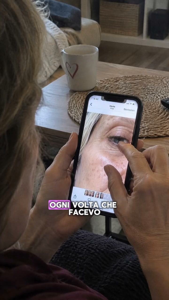 Collagene best-seller: Sviluppato da esperti, amato dalle clienti – il collagene che funziona davvero!