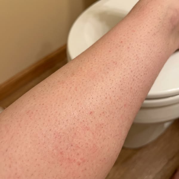 That $34 "sensitive skin" gel was never going to fix it, and neither was the next one.