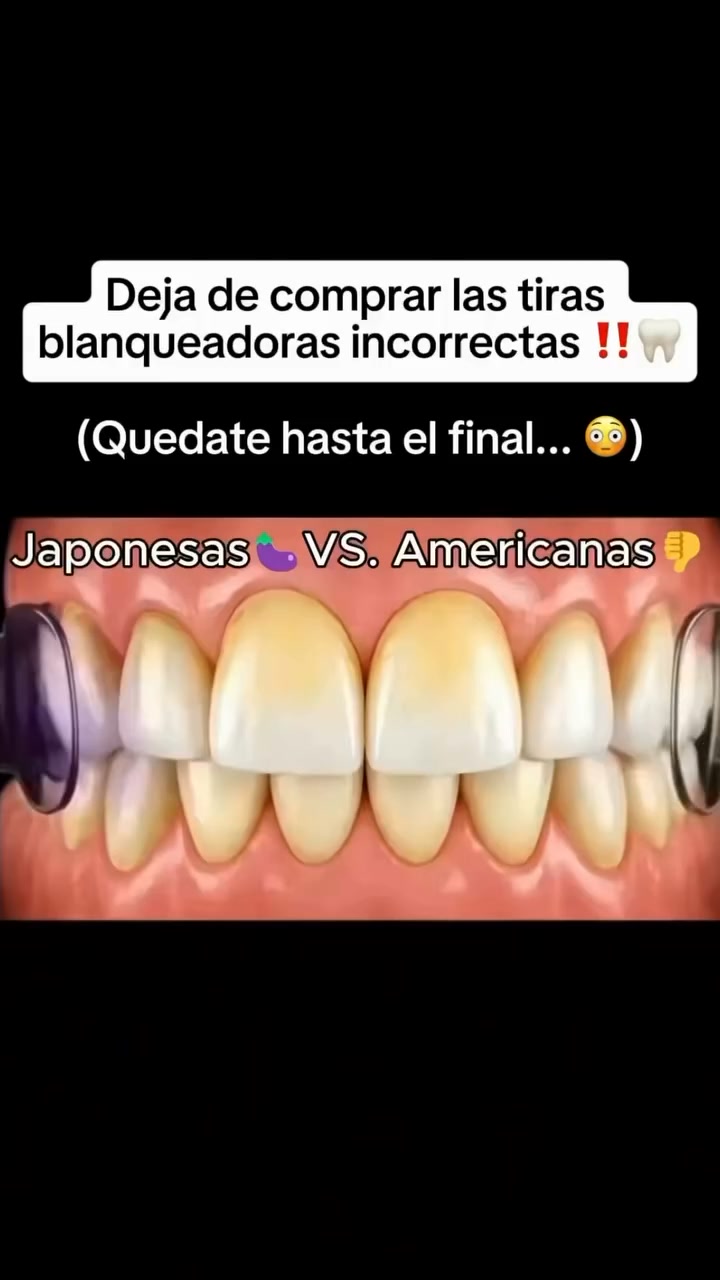 Dientes blancos en 30 minutos — sin dentista, sin dolor