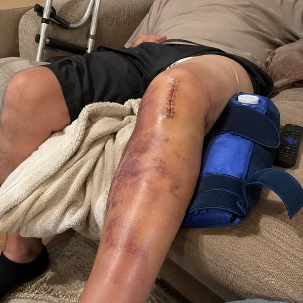 "12 years of knee pain gone in 2 days?"