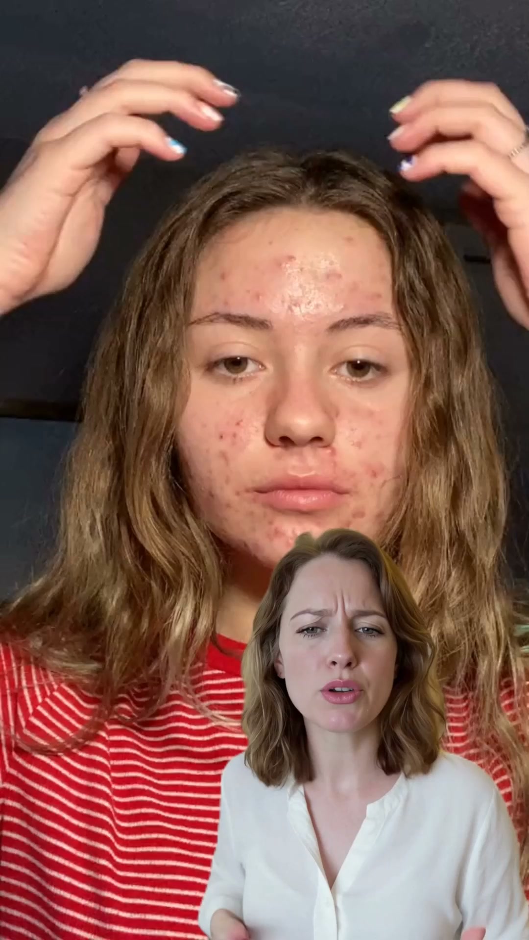 How I finally cleared my skin