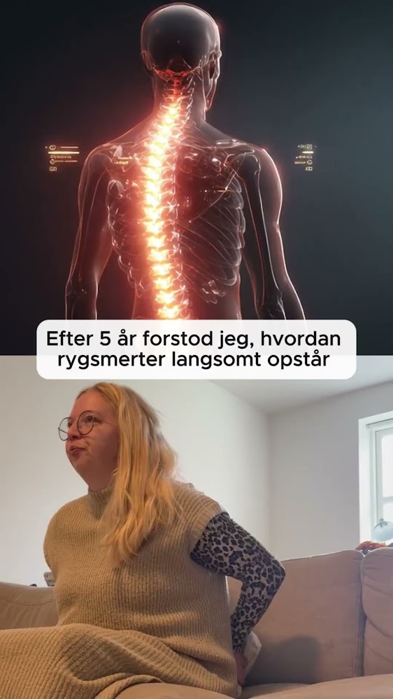 Når rygsmerter bliver en del af hverdagen