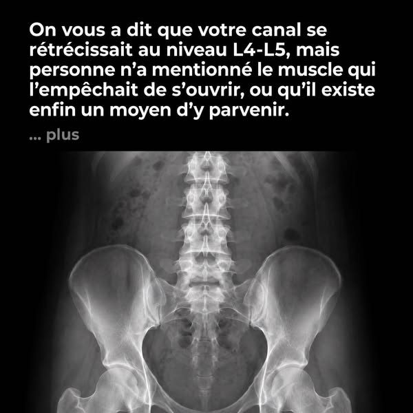 Le rétrécissement L4-L5 est lié à un muscle qui peut enfin être atteint