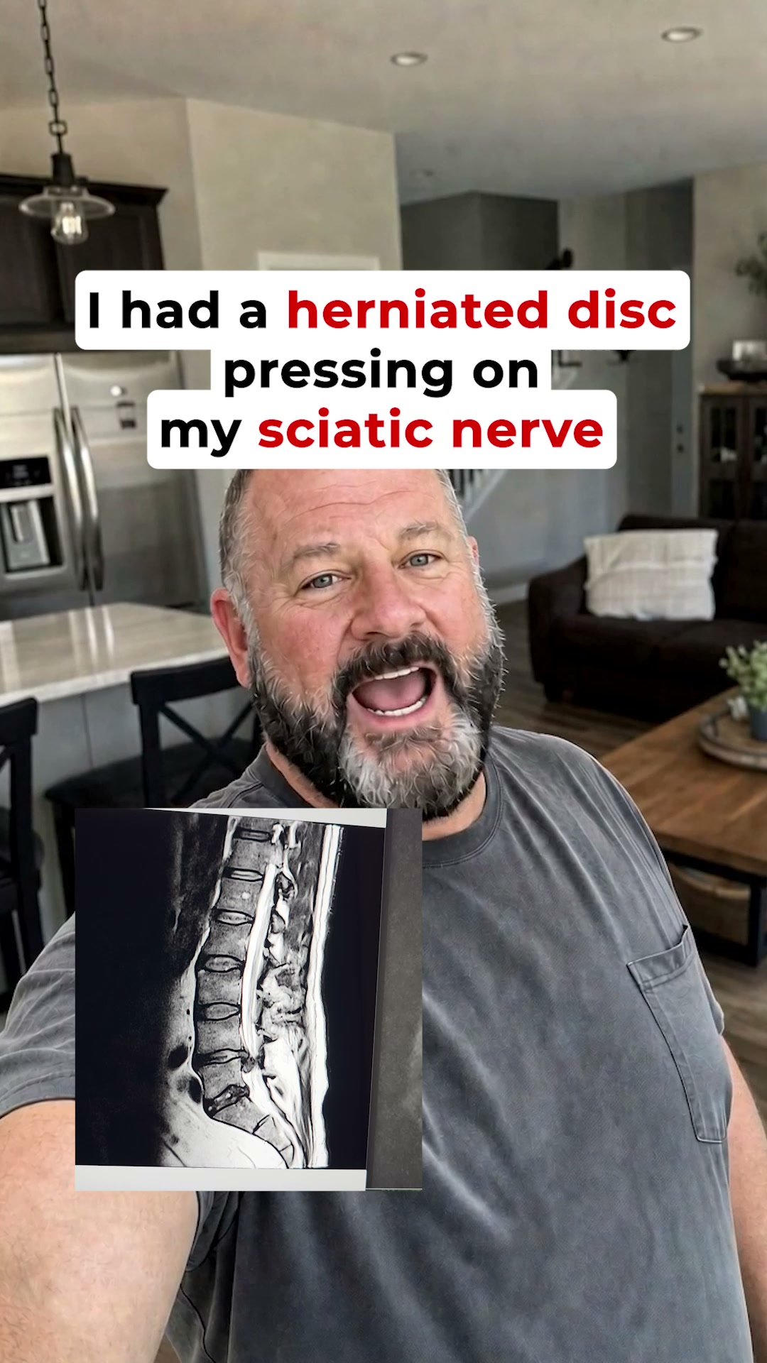 Can chronic sciatica be treated in less than 2 weeks?