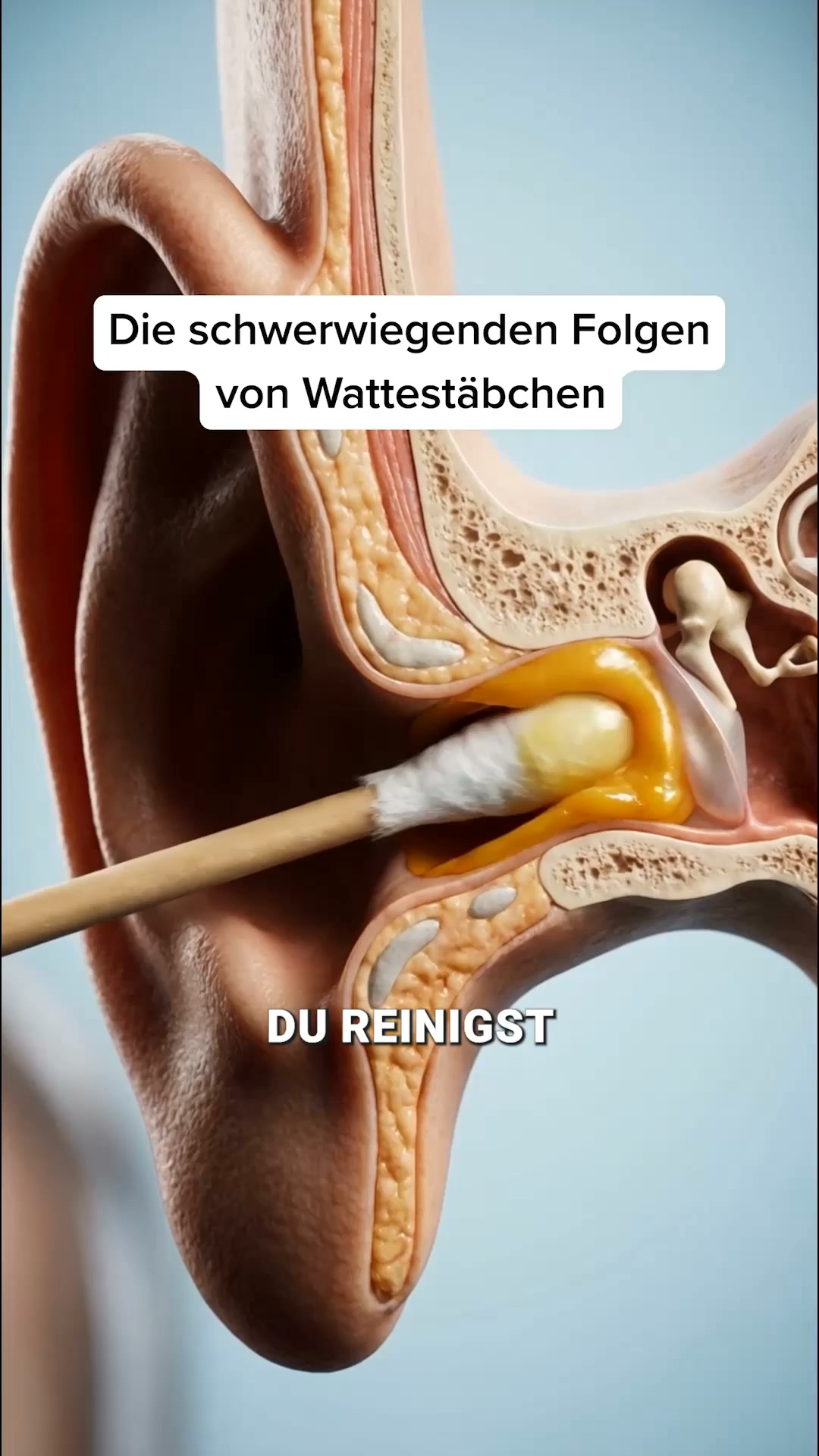 Endlich saubere & freie Ohren