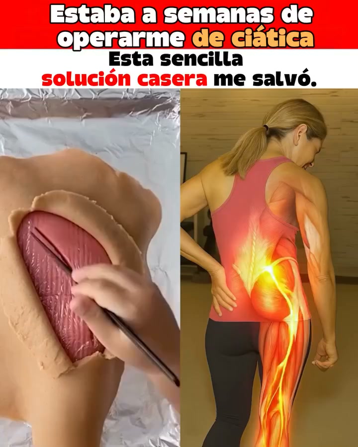 SomniX™ Pro — Alivia el dolor de espalda y ciática