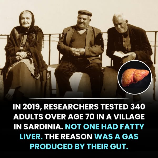 Why Sardinians rarely develop fatty liver