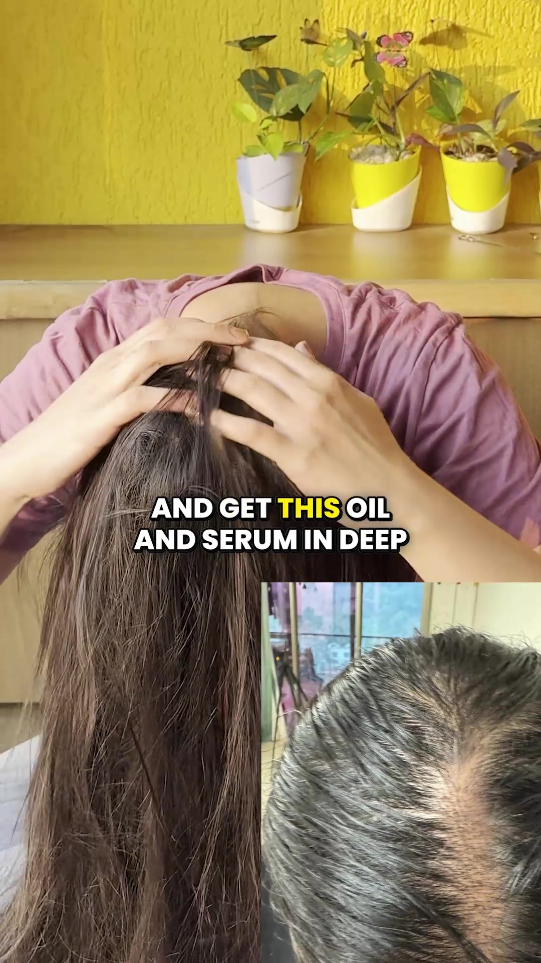 2X more powerful than Minoxidil