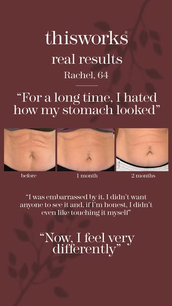 “I hated how it looked”