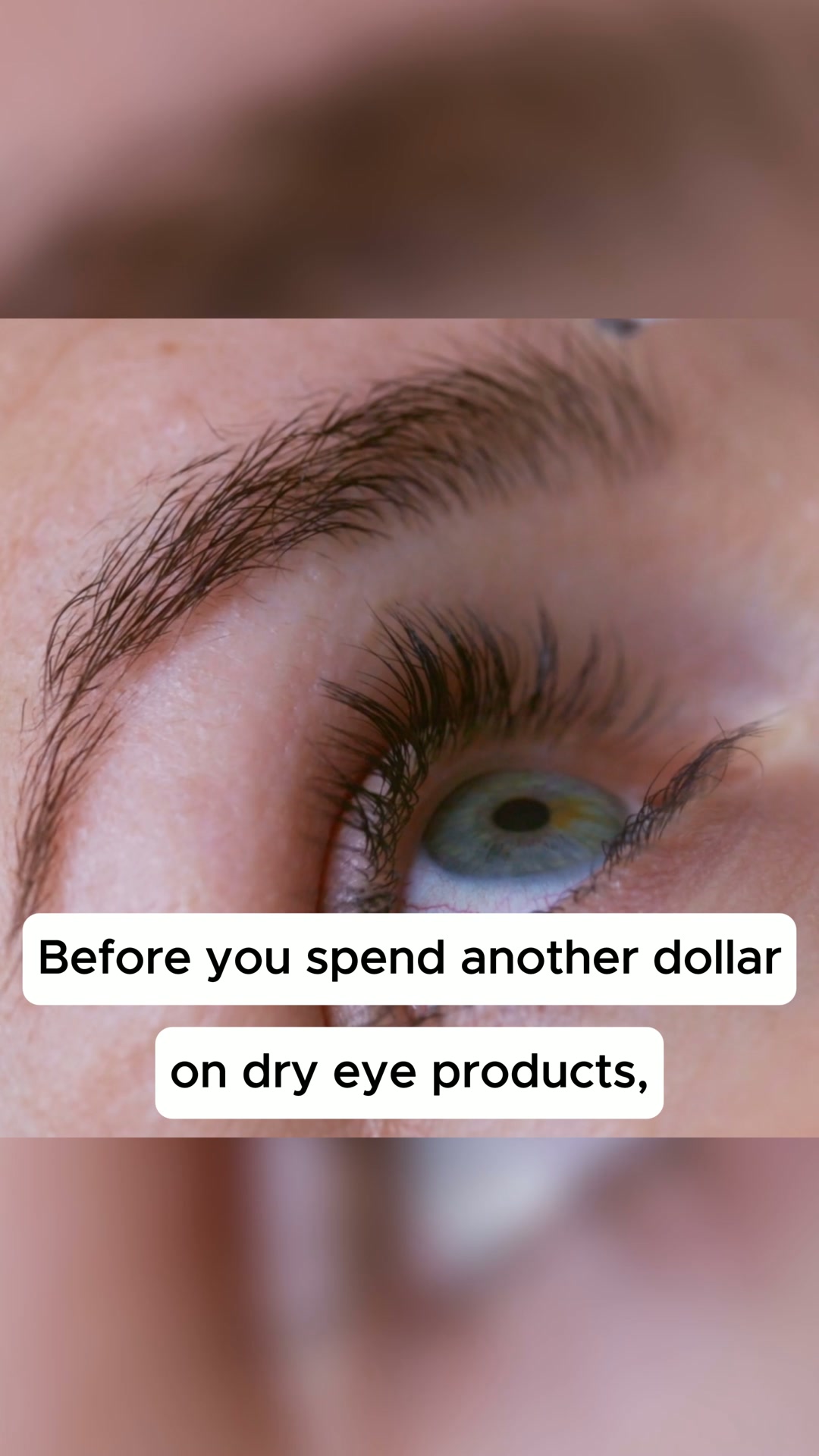 Never Use Eye Drops Again!