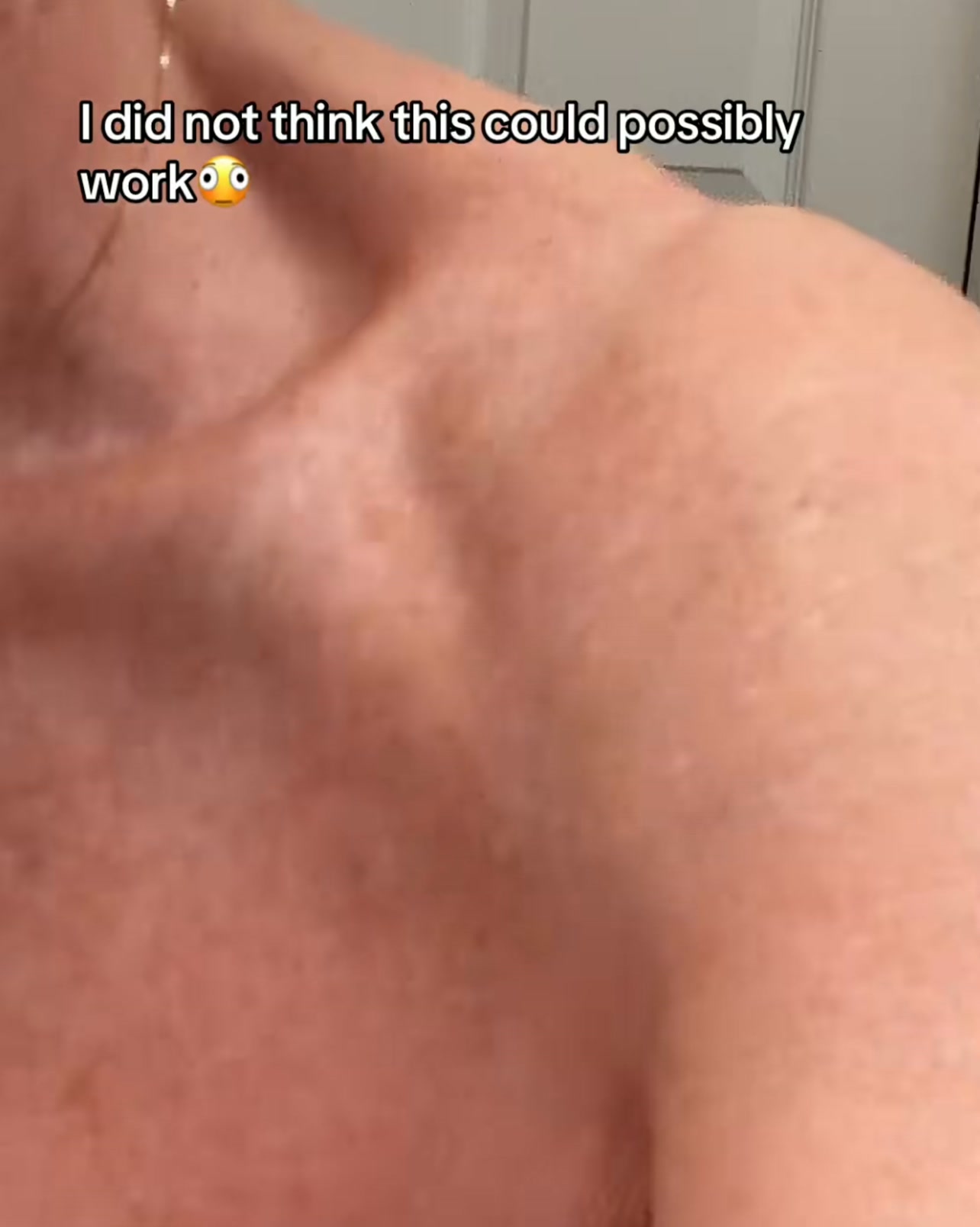 Smoother Skin in 4 Weeks