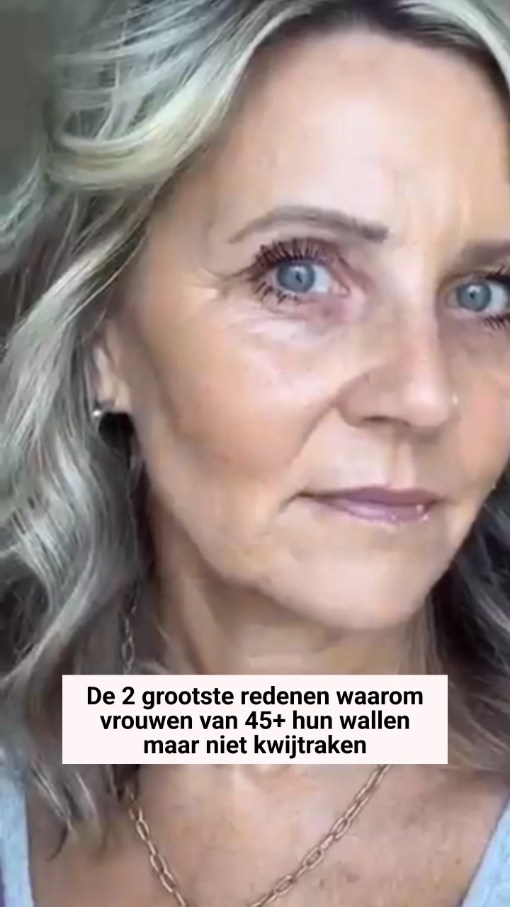 Dermatoloog: Doe DIT Voor Je Wallen >>