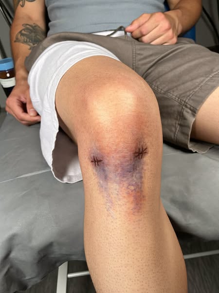 Read This If You Have Bad Knees