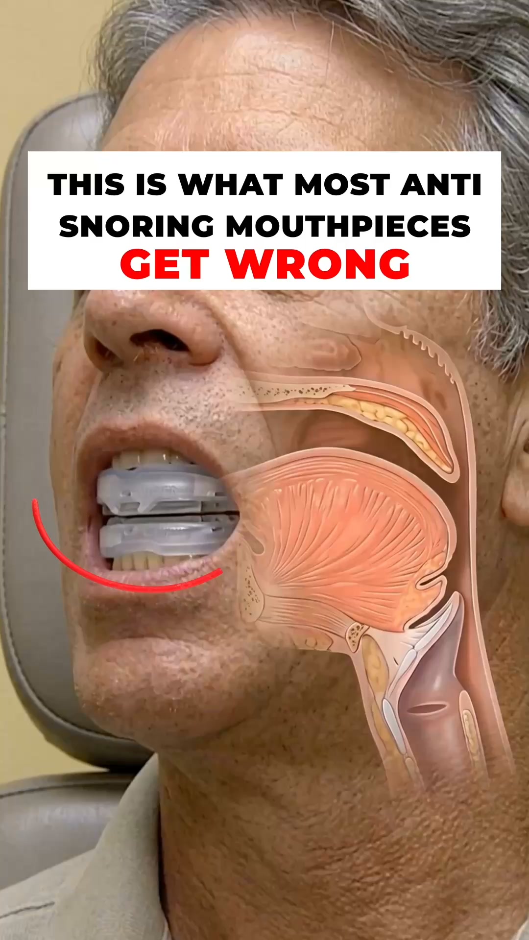 Fix Snoring & Sleepless Nights