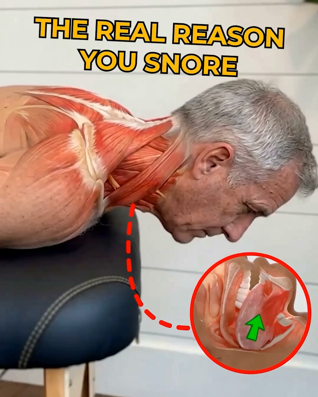 Fix Snoring & Sleepless Nights
