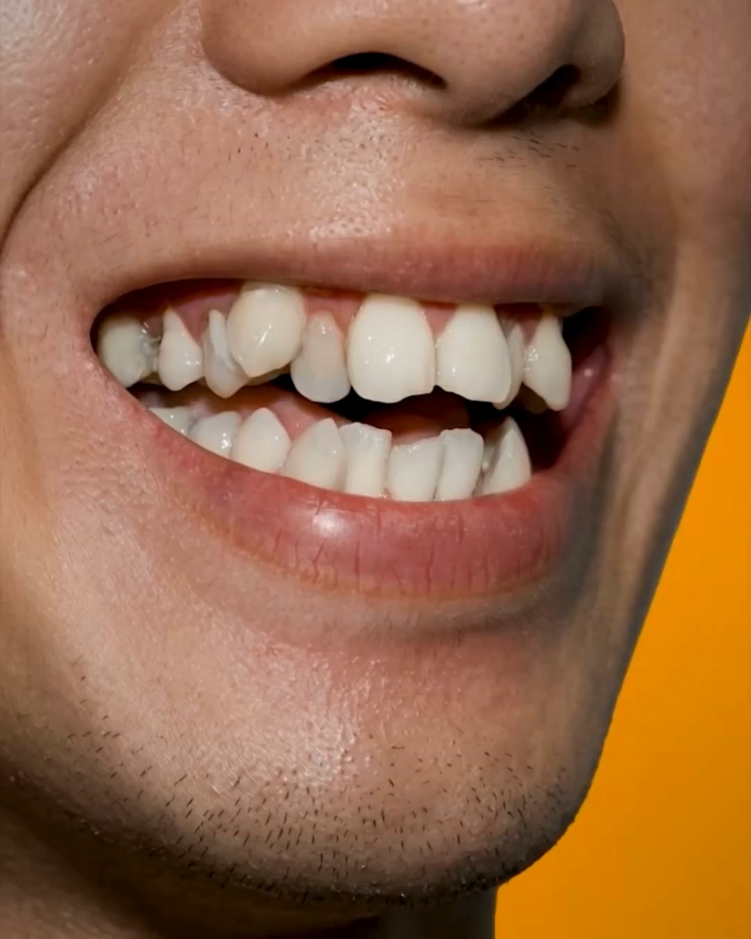 A Smarter Approach to Teeth Alignment