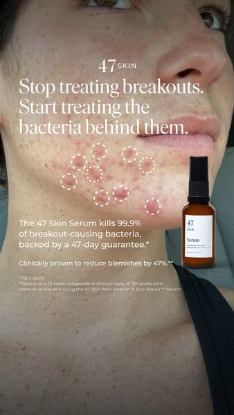 A skin treatment that actually works