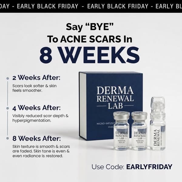 Fastest Way To Fade Acne Scars