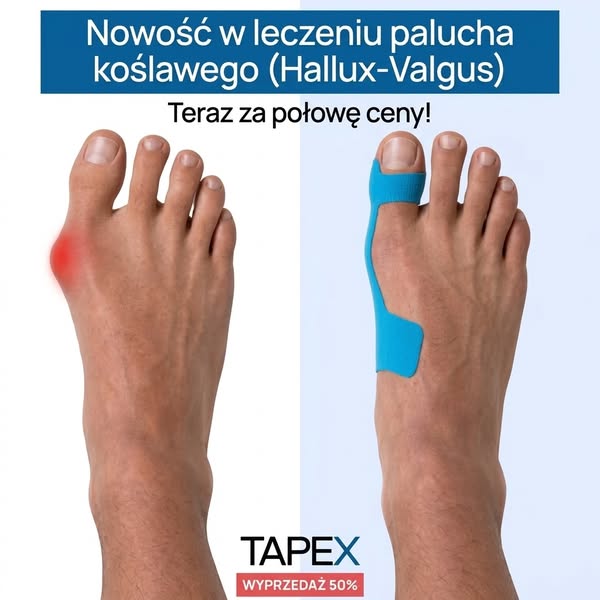 Taśma korygująca Hallux Valgus