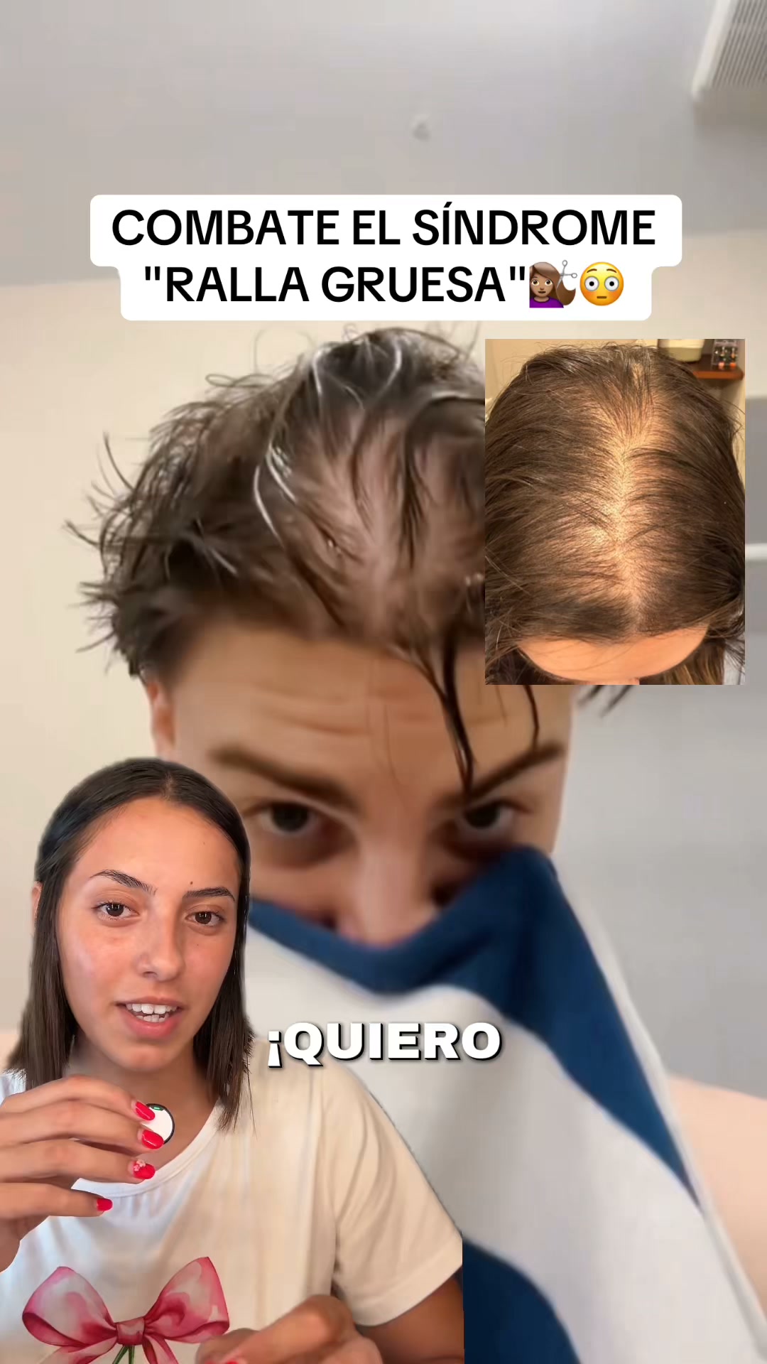 Tienes pelo fino y quieres prevenir la caída antes de que sea tarde