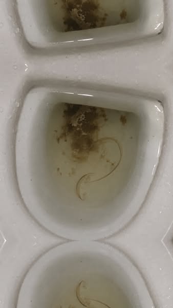 The Gross Photo Made Me Stop. The Symptoms Made Me Read.