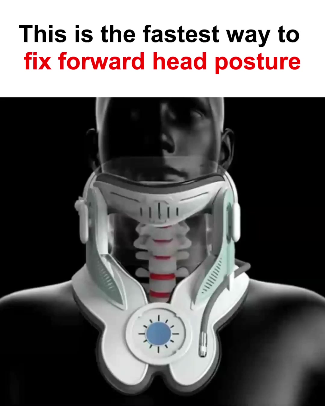 Eliminate Neck Pain & Poor Neck Posture For Good!