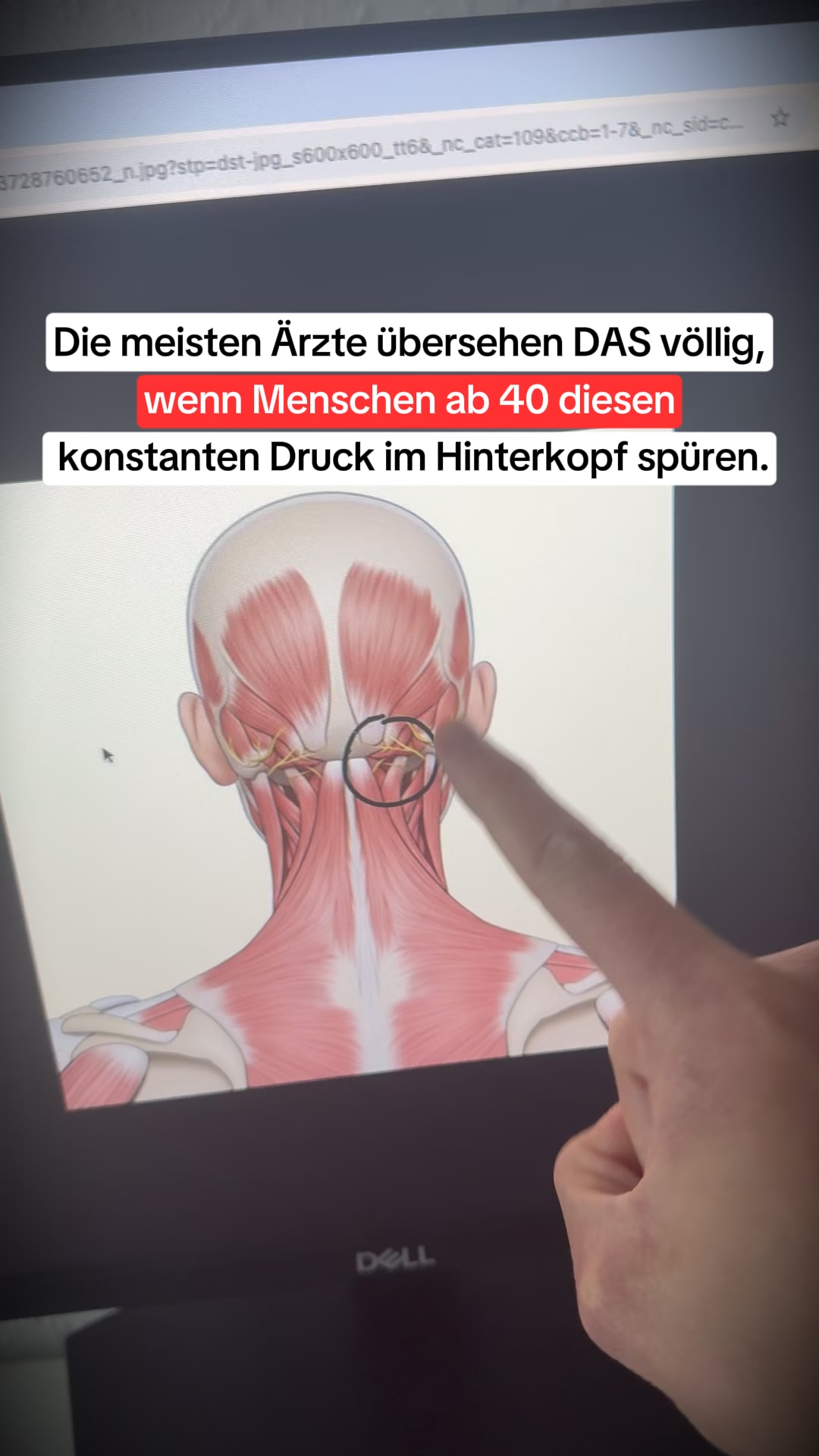 Endlich beschwerdefrei