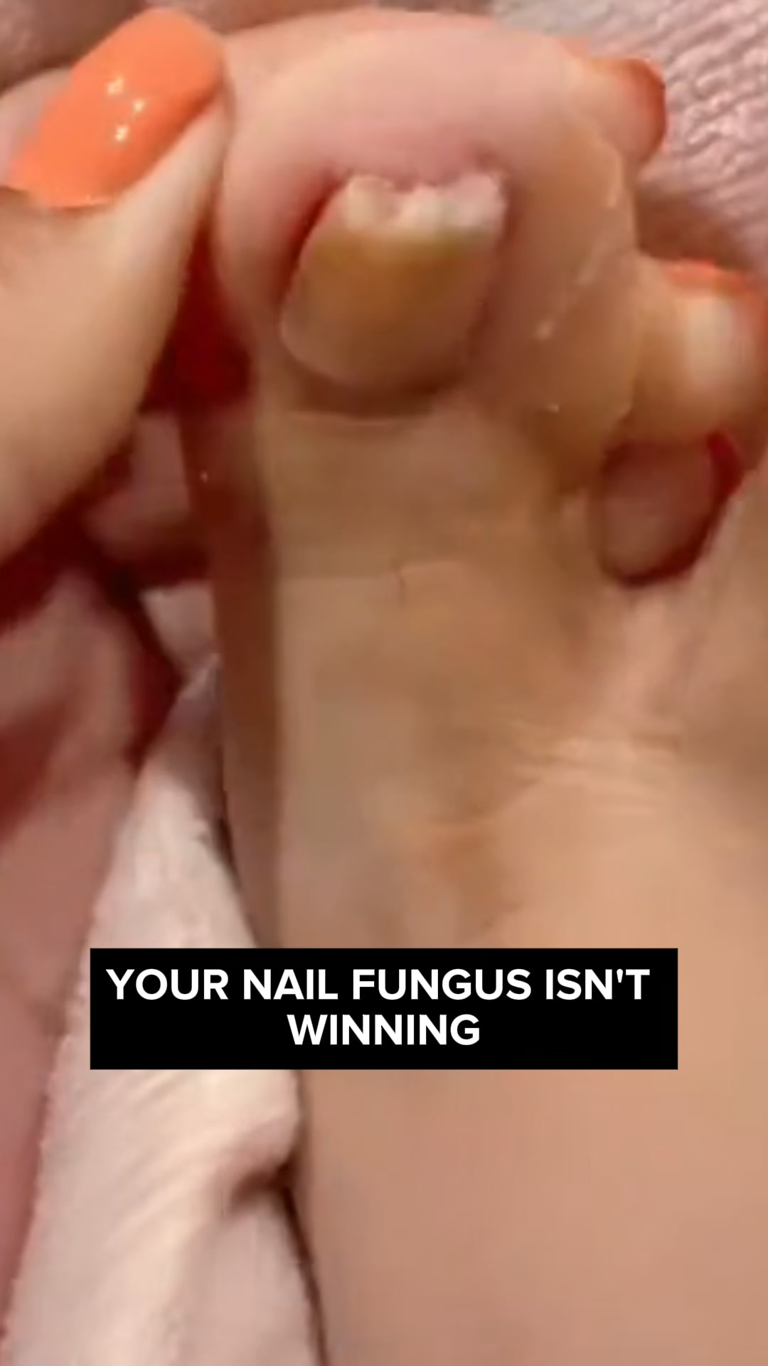 Orgatics makes your toenails look healthy again