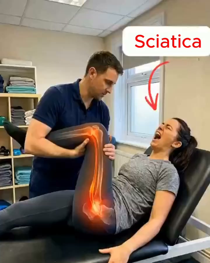 Every sciatica treatment failed for the same reason — they never reached this