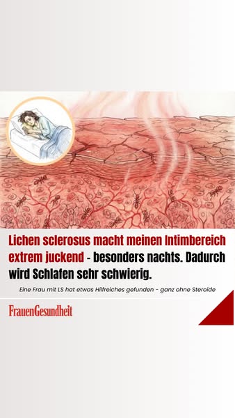 Probieren Sie das, wenn der Juckreiz schlimmer zurückkommt (schonender für Ihre Haut)