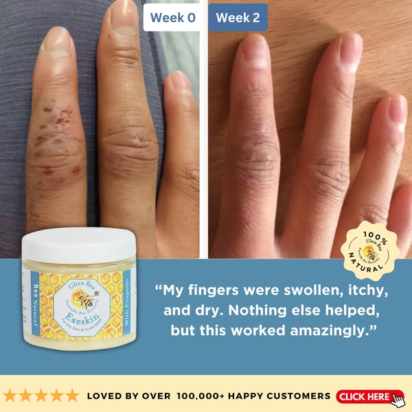 Bee-utiful Skin Starts Here!