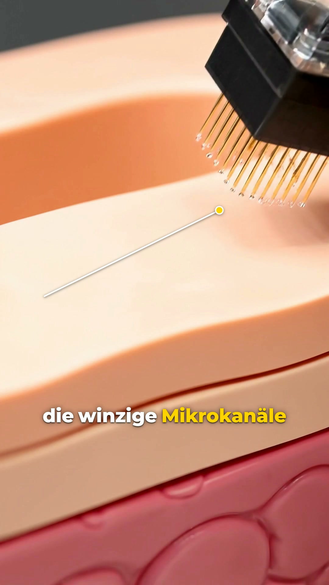 Microneedling-Infusion-Kur für zu Hause